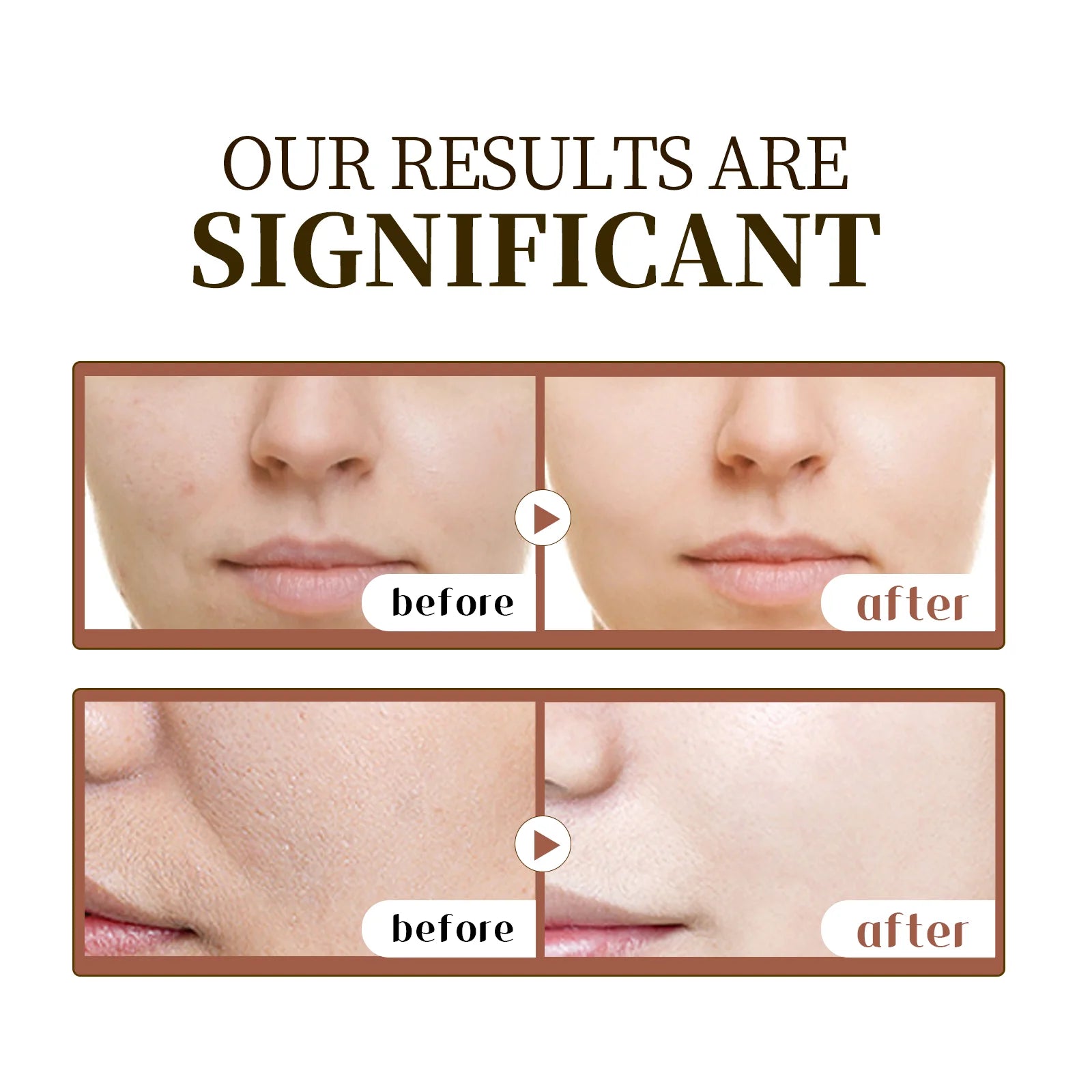 Pure Centella Face Serum (55ml)